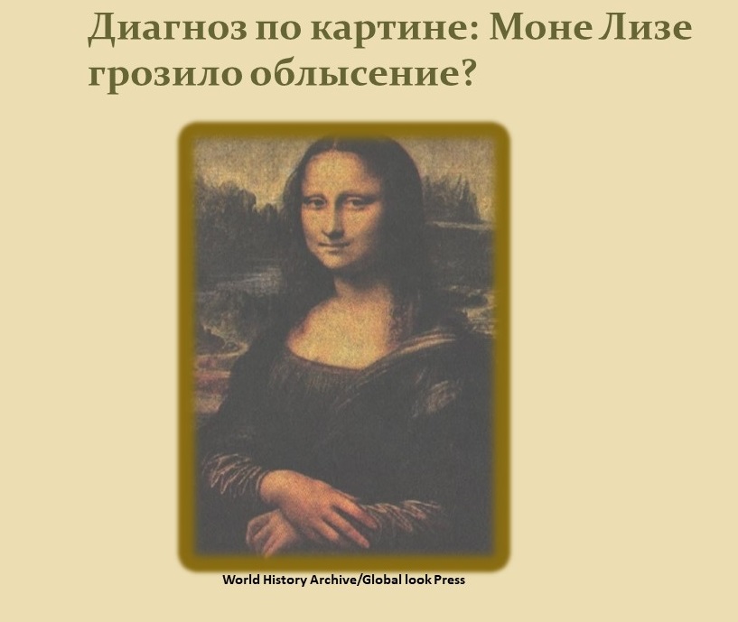Диагноз по картине: Моне Лизе грозило облысение?